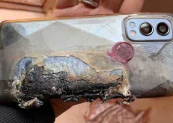 OnePlus Nord 2 5G a pris feu : L&rsquo;incident a causé de graves brûlures à la victime